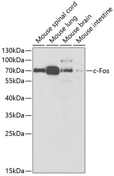 FOS Antibody
