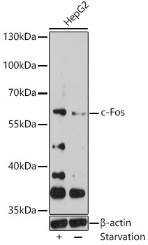FOS Antibody