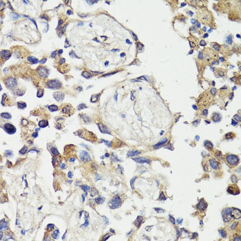 FOS Antibody