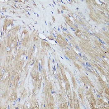 FOS Antibody