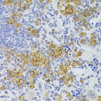 FAS Antibody