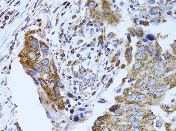 FABP4 Antibody