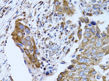 FABP4 Antibody