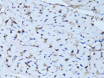 FABP4 Antibody