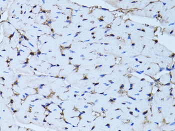 FABP4 Antibody