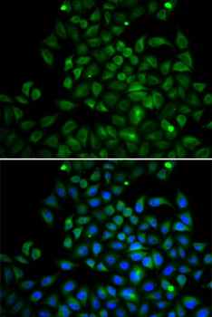 FABP4 Antibody