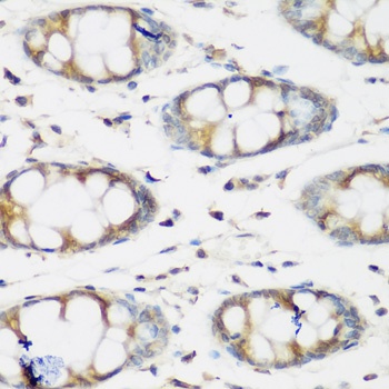 BMP2 Antibody