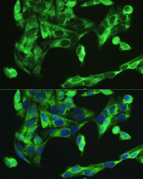 BMP2 Antibody