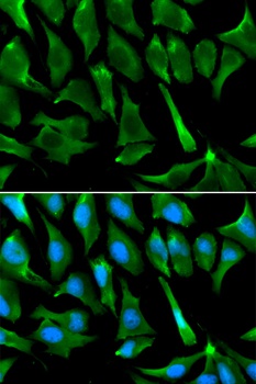 BRCA1 Antibody