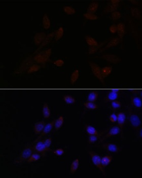 ATF4 Antibody