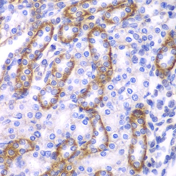 ARRB1 Antibody