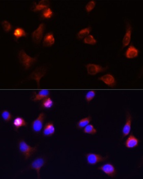 ARRB1 Antibody