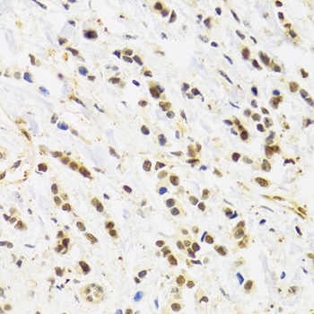 RAD50 Antibody