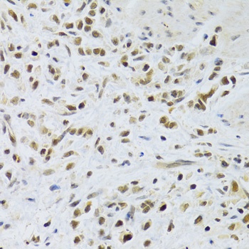 RAD50 Antibody