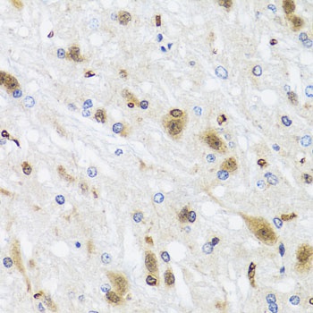 HDAC4 Antibody