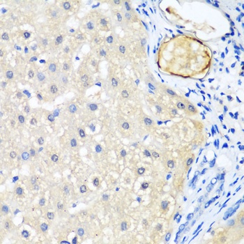 LRP5 Antibody