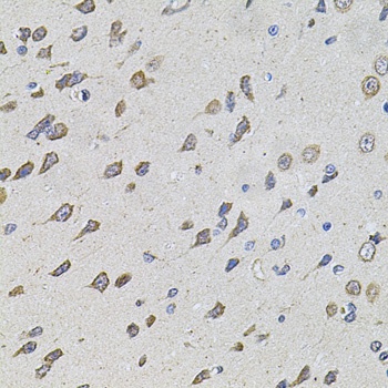FoxO3a Antibody