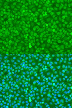 FoxO3a Antibody