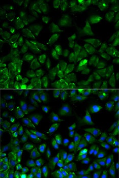 EEF2 Antibody