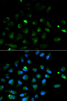 Perforin Antibody