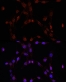 PARP1 Antibody