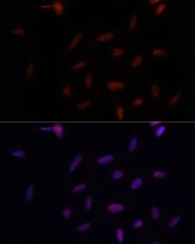 PARP1 Antibody