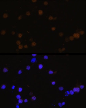 RB1 Antibody