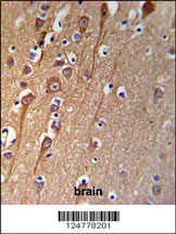 CI091 Antibody