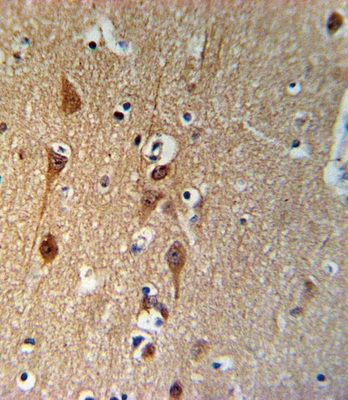 SMAD3-S208 Antibody