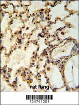 IMMP2L Antibody