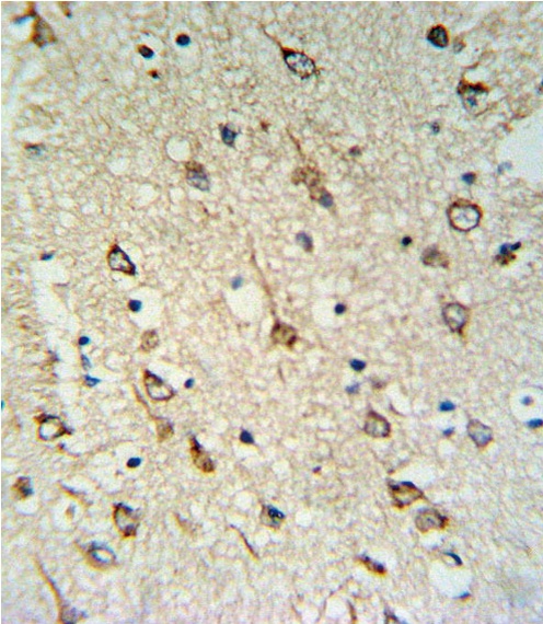 DNAJC6 Antibody