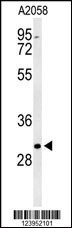 BASP1 Antibody