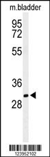 BASP1 Antibody