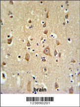 FAM44B Antibody