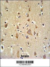 BOD1 Antibody