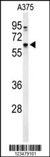DCT Antibody
