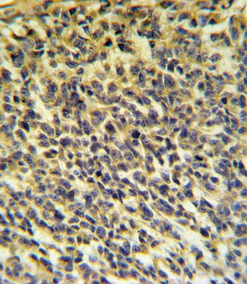 PLA2G6 Antibody