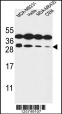 STX10 Antibody