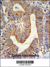 RPL17 Antibody