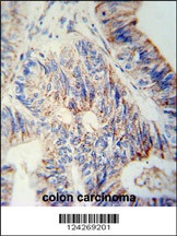 B3GNT6 Antibody