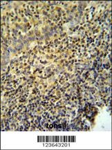 WAS Antibody