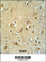 CDH20 Antibody