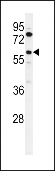 ACSBG2 Antibody