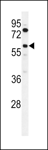 ACBG2 Antibody