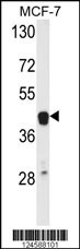 ETS2 Antibody