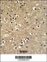 ETS2 Antibody