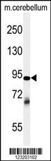 ZRANB1 Antibody