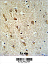 ZRANB1 Antibody