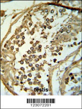 C19orf18 Antibody