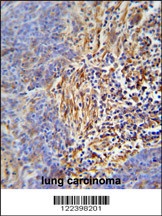 HLA-DRB5 Antibody